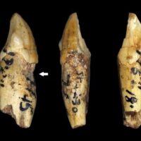 ANCESTRAIS HUMANOS TIVERAM OS MESMOS PROBLEMAS DENTÁRIOS QUE NÓS – MESMO SEM CONSUMIR AÇÚCAR, REFRIGERANTE, ETC